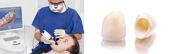 Digital dentistry - ceramics on the same day