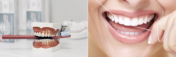 Prevention through professional dental hygiene